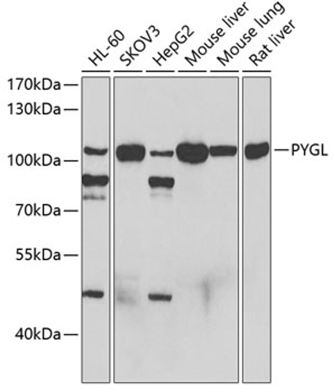 Western blot analysis of extracts of various cell lines, using PYGL antibody (22-426) at 1:1000 dilution.<br/>Secondary antibody: HRP Goat Anti-Rabbit IgG (H+L) at 1:10000 dilution.<br/>Lysates/proteins: 25ug per lane.<br/>Blocking buffer: 3% nonfat dry milk in TBST.<br/>Detection: ECL Basic Kit.<br/>Exposure time: 90s.