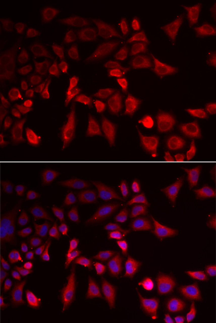 Immunofluorescence analysis of MCF-7 cells using PYGL antibody (22-426) . Blue: DAPI for nuclear staining.