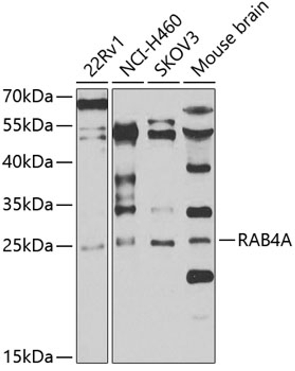 Western blot analysis of extracts of various cell lines, using RAB4A antibody (22-428) at 1:1000 dilution._Secondary antibody: HRP Goat Anti-Rabbit IgG (H+L) at 1:10000 dilution._Lysates/proteins: 25ug per lane._Blocking buffer: 3% nonfat dry milk in TBST._Detection: ECL Enhanced Kit._Exposure time: 30s.