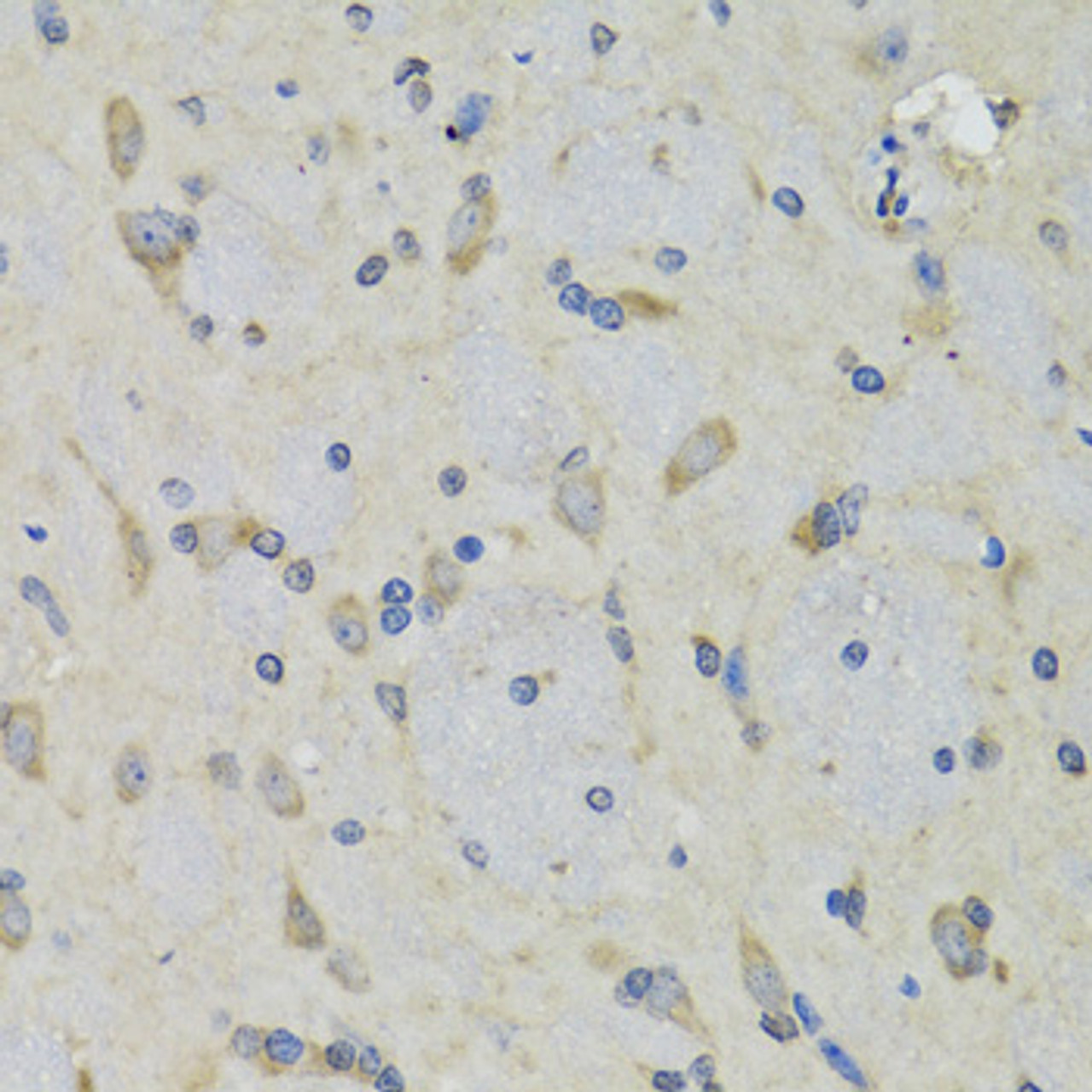 Immunohistochemistry of paraffin-embedded rat brain using RAE1 antibody (22-429) at dilution of 1:100 (40x lens) .