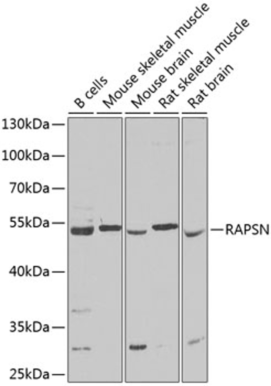 Western blot analysis of extracts of various cell lines, using RAPSN Antibody (22-432) at 1:1000 dilution.<br/>Secondary antibody: HRP Goat Anti-Rabbit IgG (H+L) at 1:10000 dilution.<br/>Lysates/proteins: 25ug per lane.<br/>Blocking buffer: 3% nonfat dry milk in TBST.<br/>Detection: ECL Basic Kit.<br/>Exposure time: 15s.