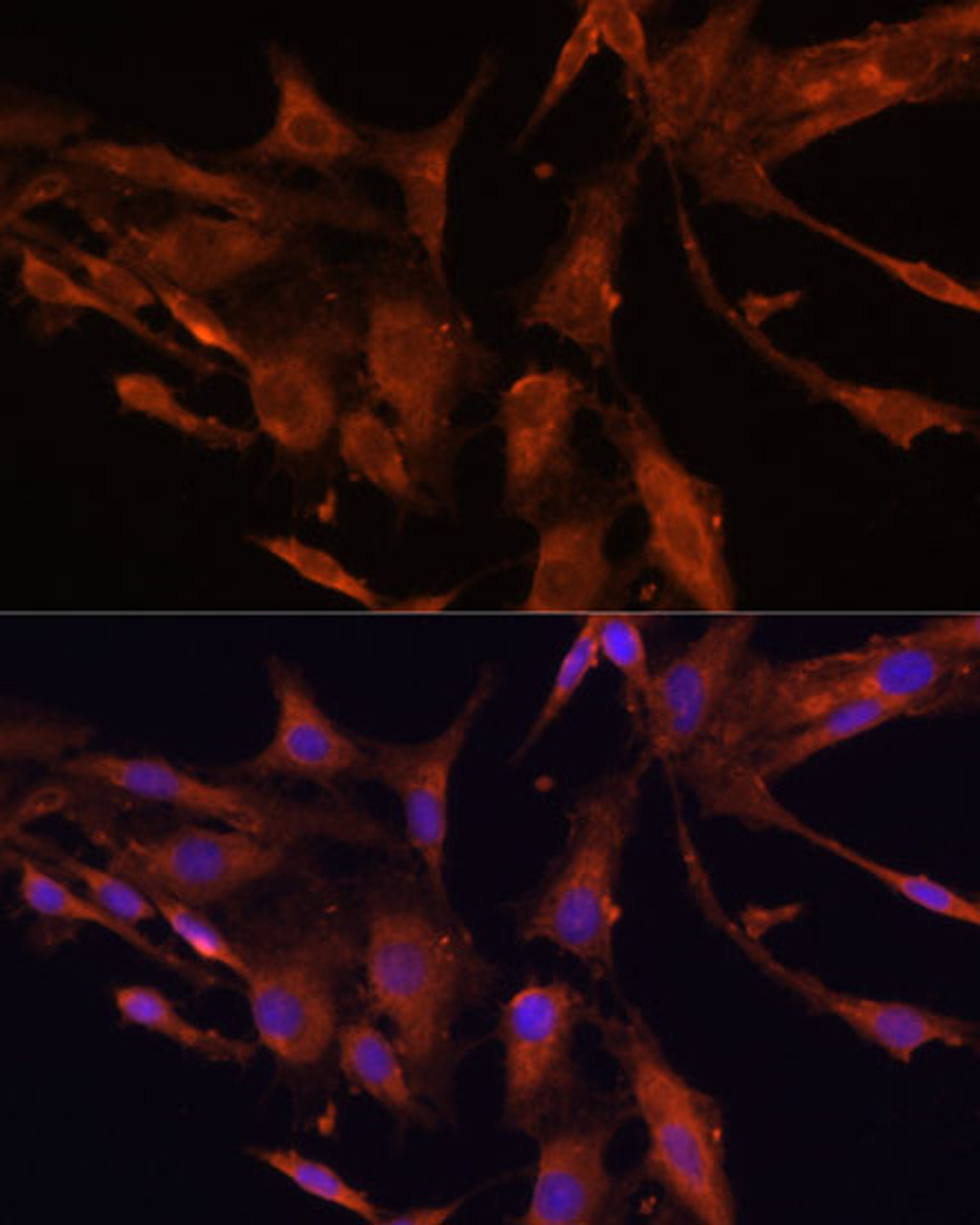 Immunofluorescence analysis of C6 cells using RECK Polyclonal Antibody (22-434) at dilution of 1:100 (40x lens) . Blue: DAPI for nuclear staining.