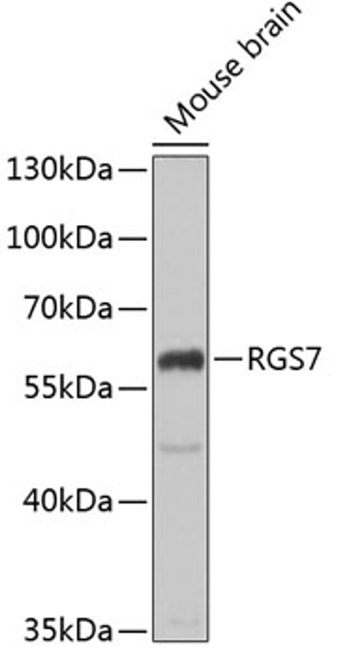 Western blot analysis of extracts of mouse brain, using RGS7 antibody (22-435) at 1:1000 dilution.<br/>Secondary antibody: HRP Goat Anti-Rabbit IgG (H+L) at 1:10000 dilution.<br/>Lysates/proteins: 25ug per lane.<br/>Blocking buffer: 3% nonfat dry milk in TBST.<br/>Detection: ECL Basic Kit.<br/>Exposure time: 1s.