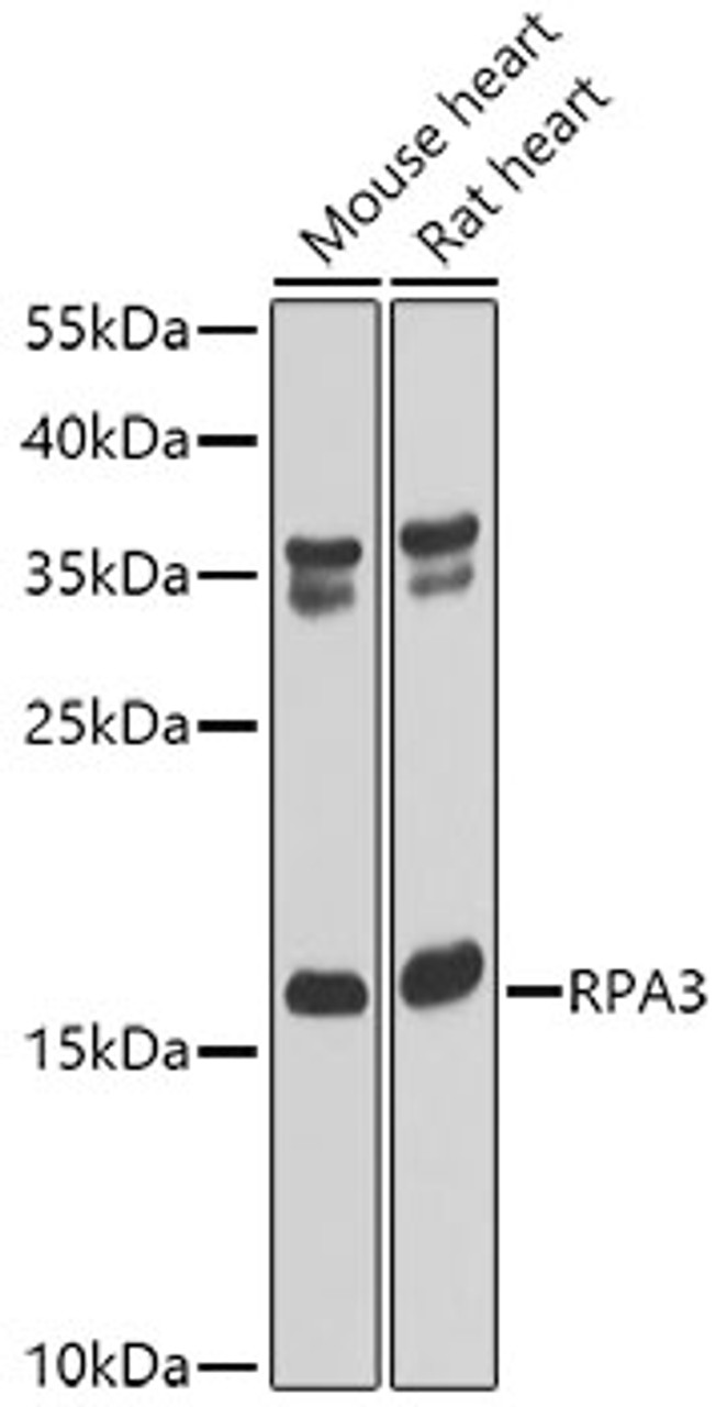 Western blot analysis of extracts of various cell lines, using RPA3 antibody (22-436) at 1:1000 dilution.<br/>Secondary antibody: HRP Goat Anti-Rabbit IgG (H+L) at 1:10000 dilution.<br/>Lysates/proteins: 25ug per lane.<br/>Blocking buffer: 3% nonfat dry milk in TBST.<br/>Detection: ECL Basic Kit.<br/>Exposure time: 60s.