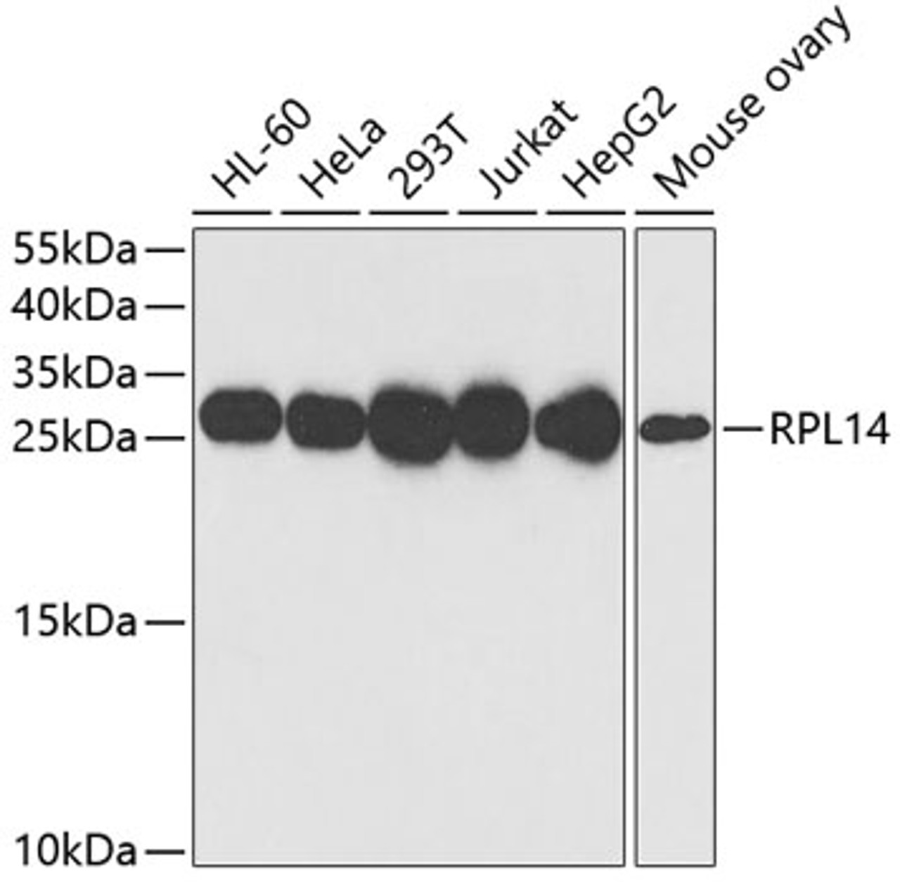 Western blot analysis of extracts of various cell lines, using RPL14 antibody (22-438) at 1:1000 dilution.<br/>Secondary antibody: HRP Goat Anti-Rabbit IgG (H+L) at 1:10000 dilution.<br/>Lysates/proteins: 25ug per lane.<br/>Blocking buffer: 3% nonfat dry milk in TBST.<br/>Detection: ECL Basic Kit.<br/>Exposure time: 10s.