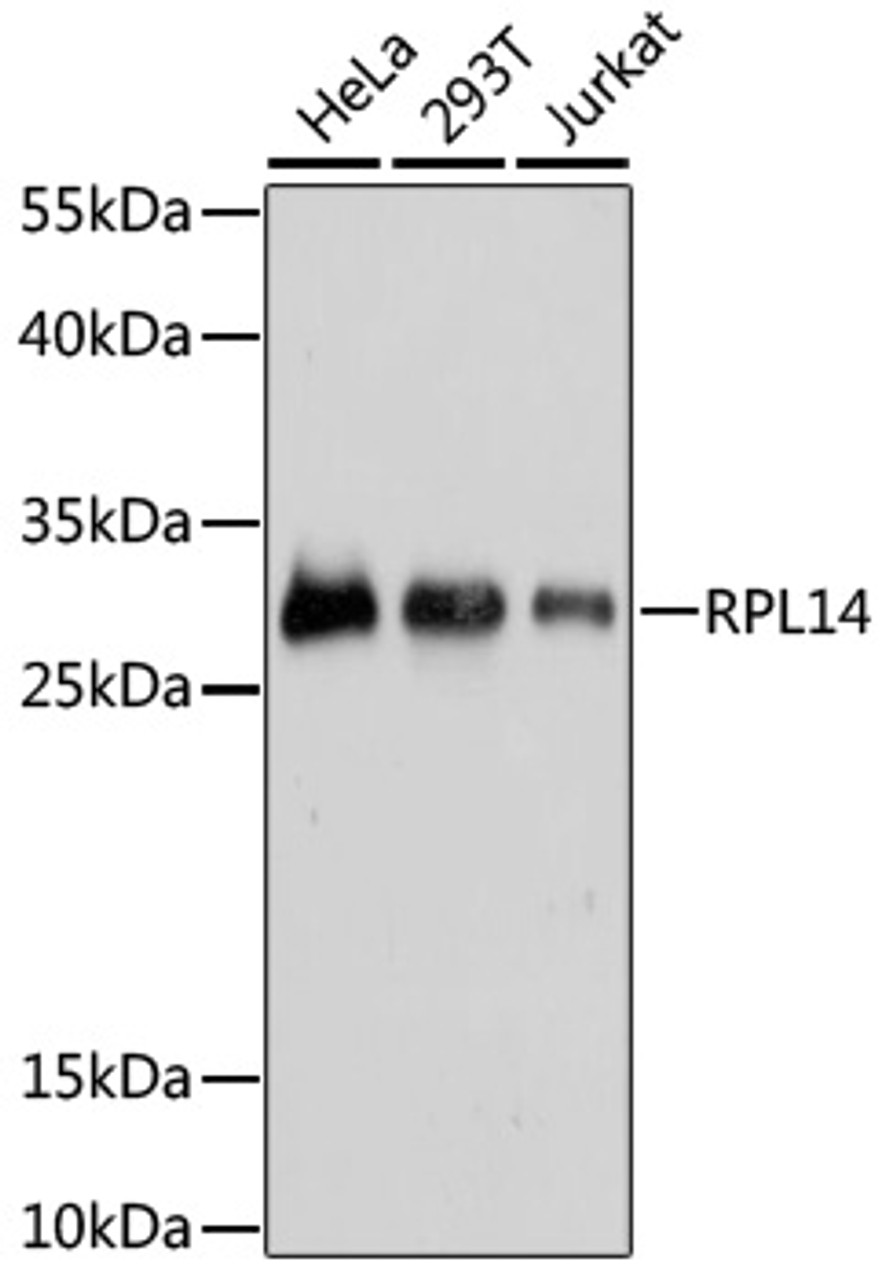 Immunohistochemistry of paraffin-embedded rat liver using RPL14 antibody (22-438) at dilution of 1:100 (40x lens) .