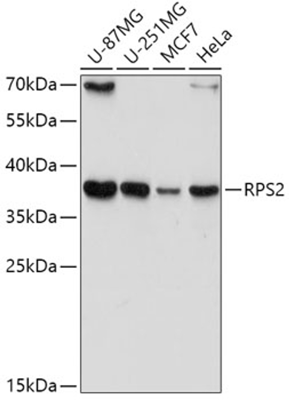 Western blot analysis of extracts of various cell lines, using RPS2 antibody (22-442) at 1:1000 dilution.<br/>Secondary antibody: HRP Goat Anti-Rabbit IgG (H+L) at 1:10000 dilution.<br/>Lysates/proteins: 25ug per lane.<br/>Blocking buffer: 3% nonfat dry milk in TBST.<br/>Detection: ECL Basic Kit.<br/>Exposure time: 15s.