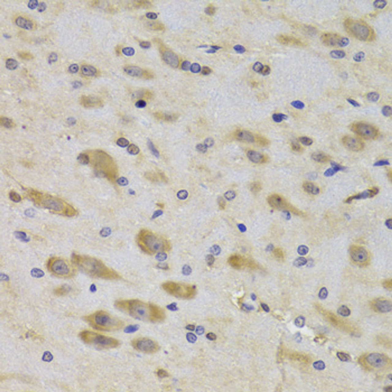 Immunohistochemistry of paraffin-embedded rat brain using RPS27 Antibody (22-443) at dilution of 1:100 (40x lens) .