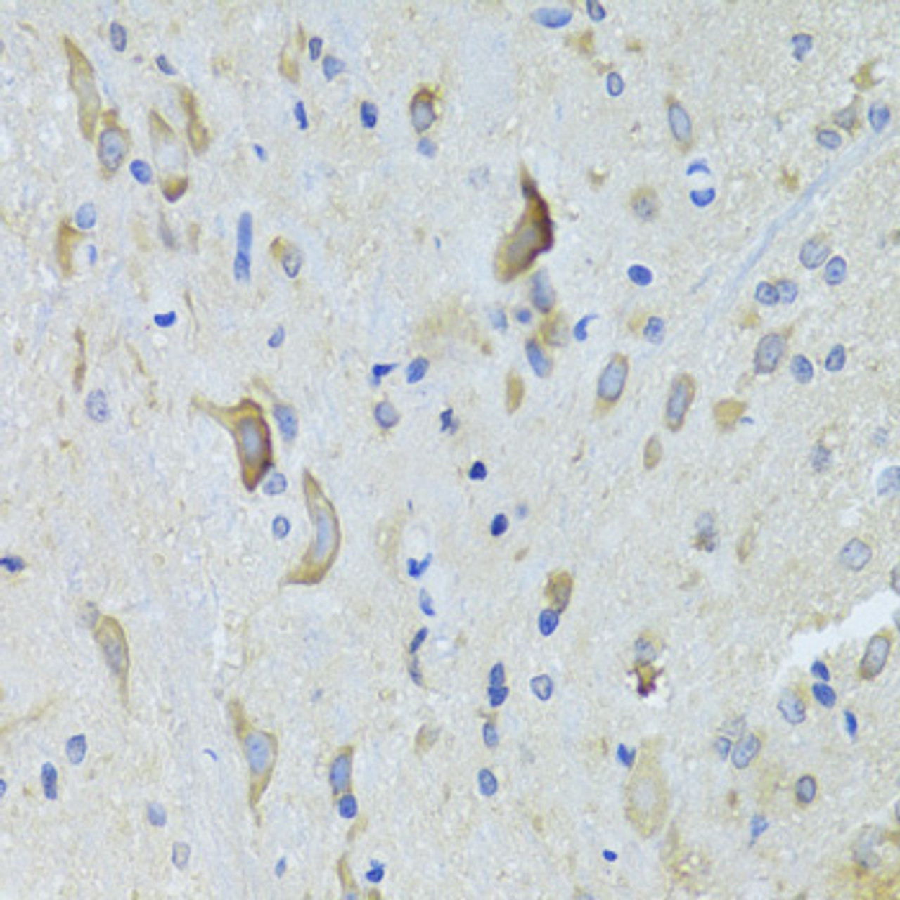 Immunohistochemistry of paraffin-embedded rat spinal cord using SARS Antibody (22-446) at dilution of 1:100 (40x lens) .