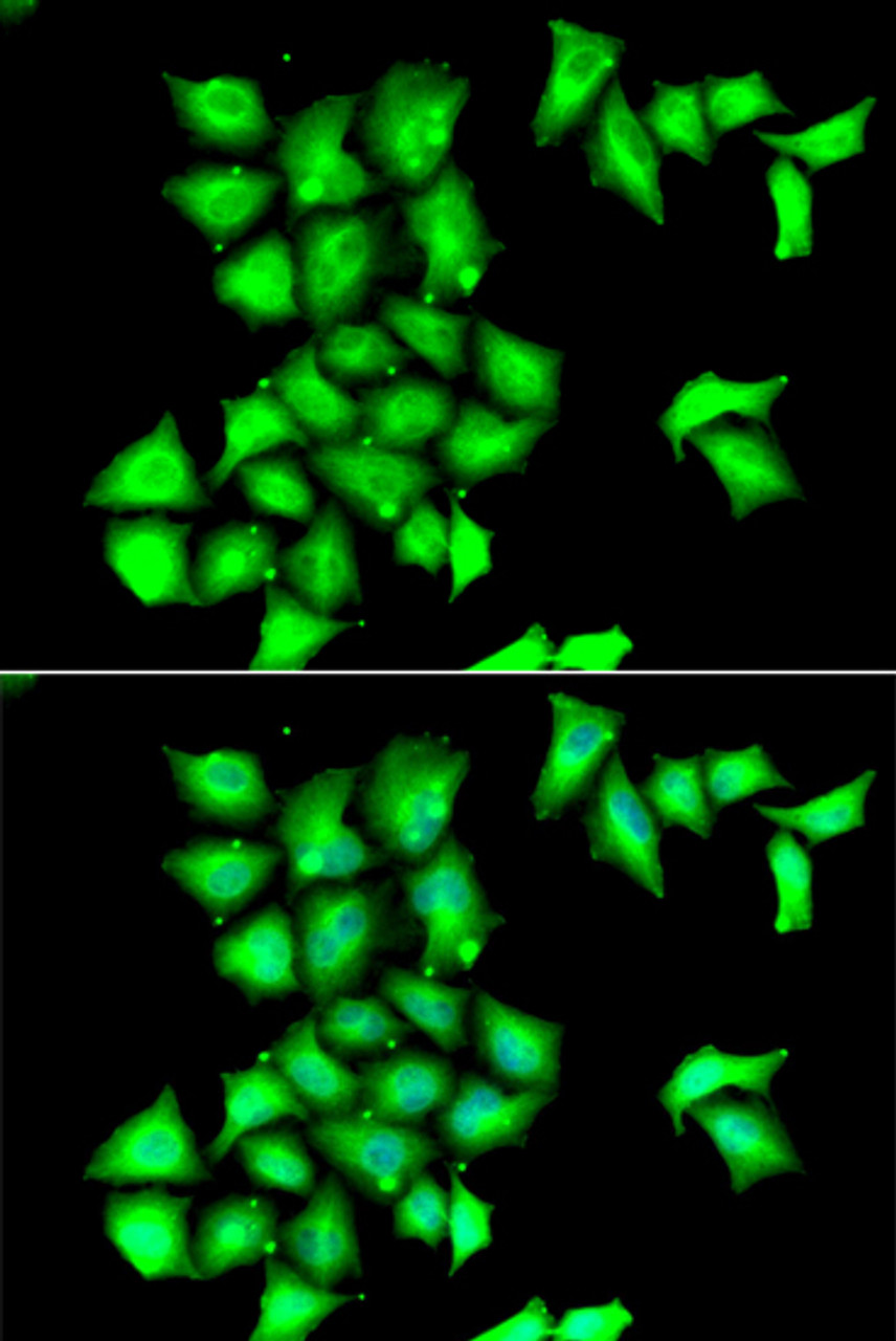 Immunofluorescence analysis of HeLa cells using MSRB1 antibody (22-449) . Blue: DAPI for nuclear staining.