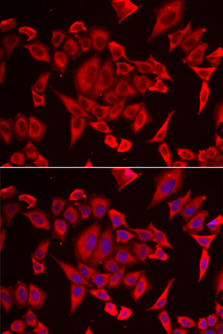 Immunofluorescence analysis of HeLa cells using SLC20A2 antibody (22-451) . Blue: DAPI for nuclear staining.