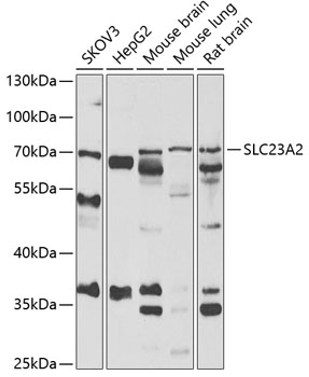 Western blot analysis of extracts of various cell lines, using SLC23A2 antibody (22-452) at 1:1000 dilution.<br/>Secondary antibody: HRP Goat Anti-Rabbit IgG (H+L) at 1:10000 dilution.<br/>Lysates/proteins: 25ug per lane.<br/>Blocking buffer: 3% nonfat dry milk in TBST.<br/>Detection: ECL Basic Kit.<br/>Exposure time: 90s.