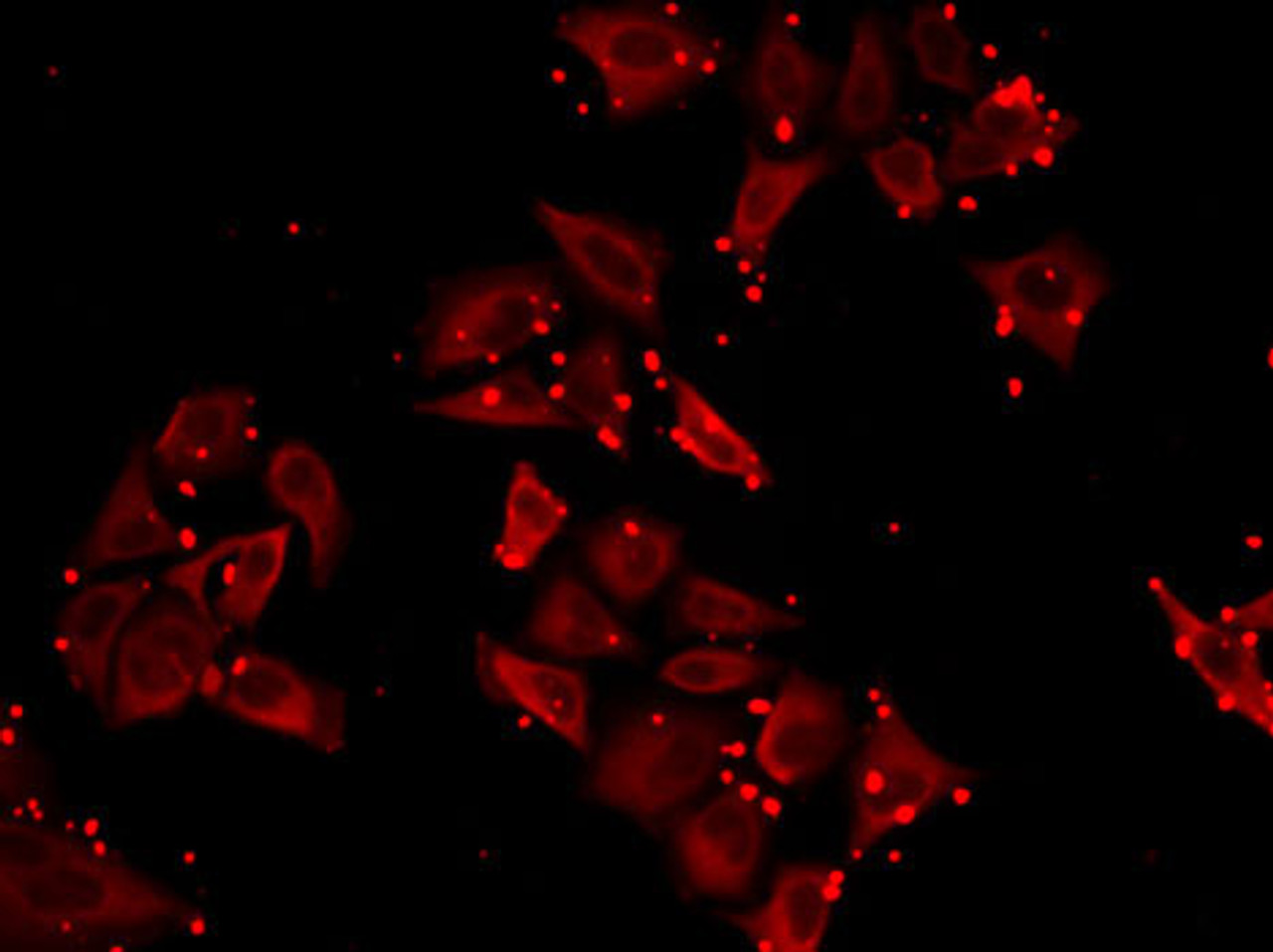 Immunofluorescence analysis of MCF7 cells using SLC23A2 antibody (22-452) .