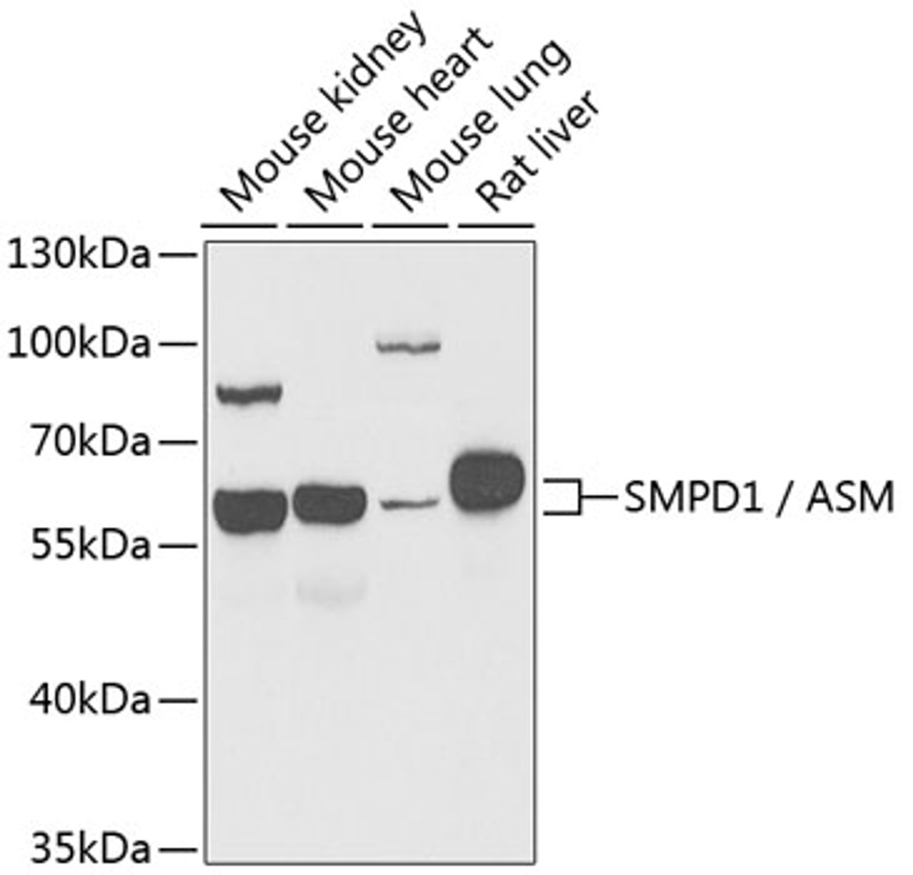 Western blot analysis of extracts of various cell lines, using SMPD1 / ASM antibody (22-454) at 1:1000 dilution.<br/>Secondary antibody: HRP Goat Anti-Rabbit IgG (H+L) at 1:10000 dilution.<br/>Lysates/proteins: 25ug per lane.<br/>Blocking buffer: 3% nonfat dry milk in TBST.<br/>Detection: ECL Basic Kit.<br/>Exposure time: 90s.