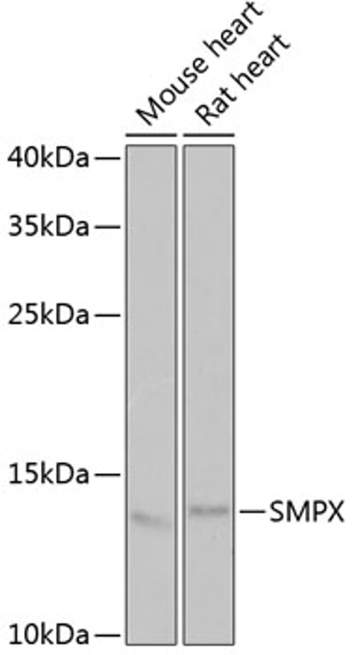 Western blot analysis of extracts of various cell lines, using SMPX antibody (22-455) at 1:1000 dilution._Secondary antibody: HRP Goat Anti-Rabbit IgG (H+L) at 1:10000 dilution._Lysates/proteins: 25ug per lane._Blocking buffer: 3% nonfat dry milk in TBST._Detection: ECL Enhanced Kit._Exposure time: 90s.