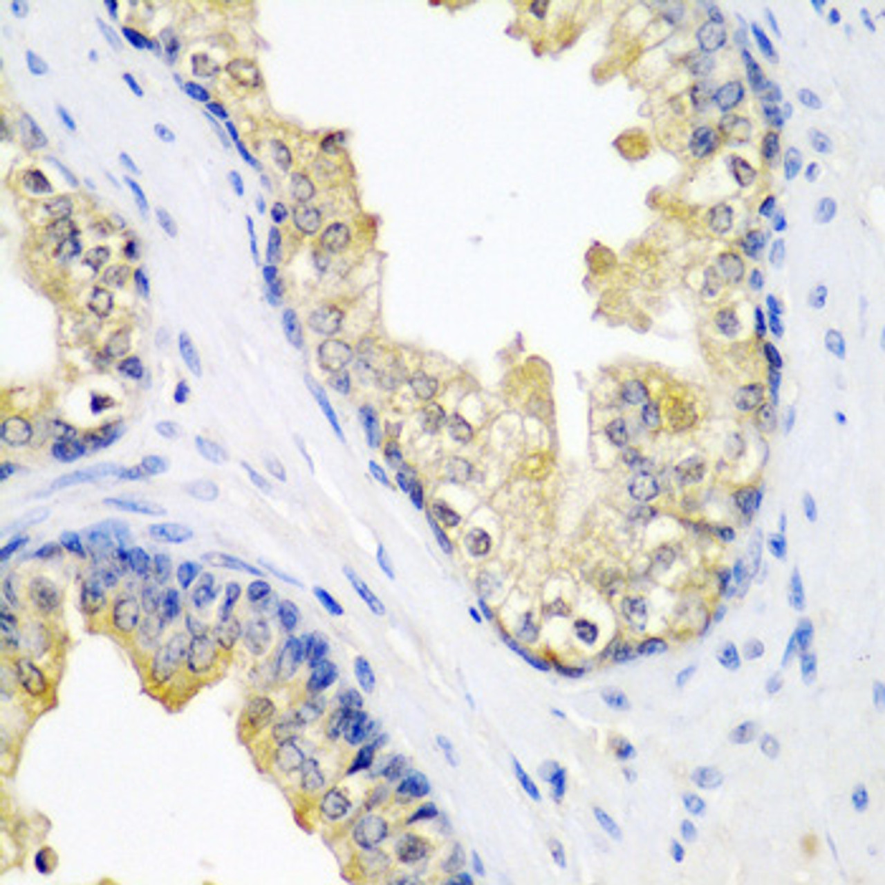 Immunohistochemistry of paraffin-embedded human prostate using SPINT2 antibody (22-459) at dilution of 1:200 (40x lens) .
