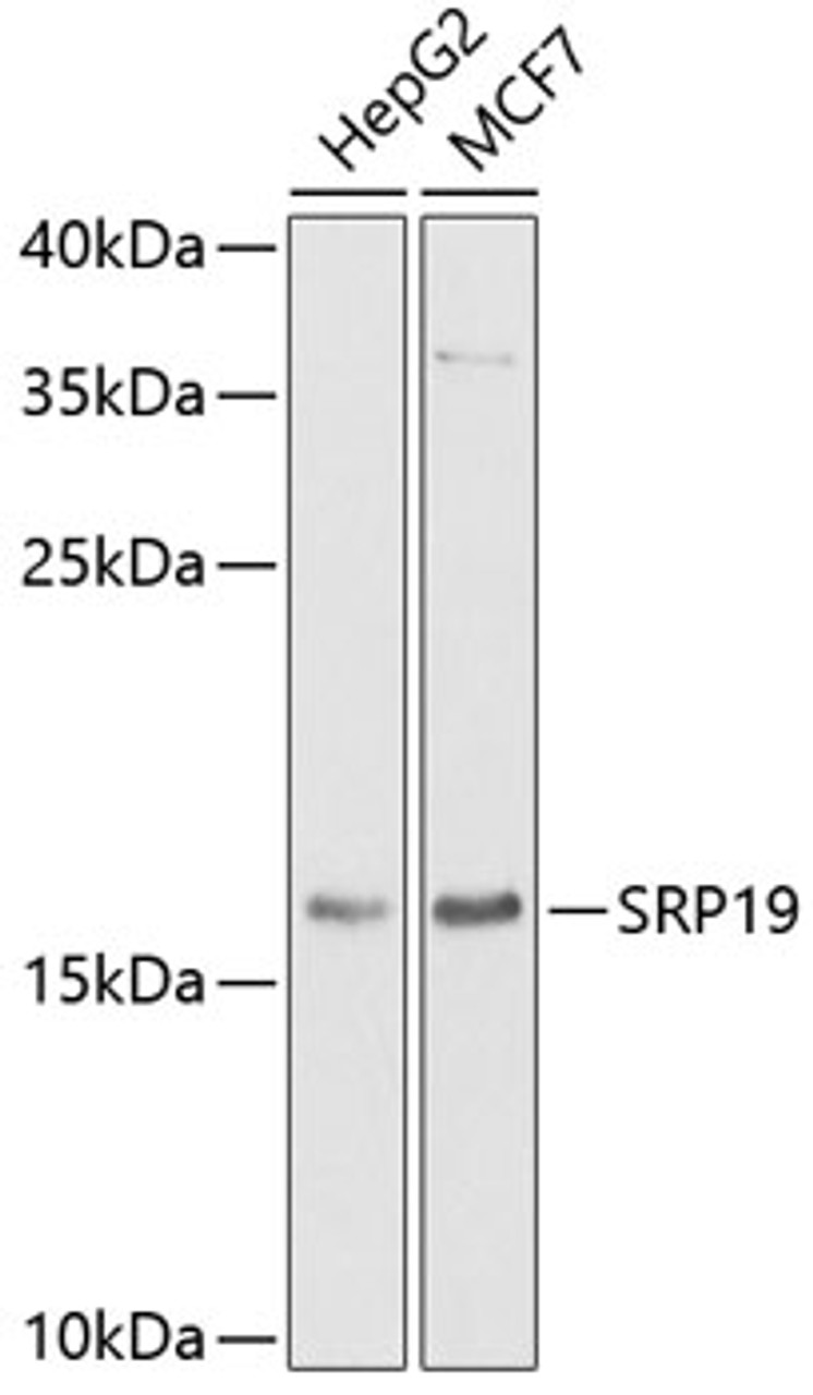 Western blot analysis of extracts of various cell lines, using SRP19 antibody (22-461) at 1:1000 dilution.<br/>Secondary antibody: HRP Goat Anti-Rabbit IgG (H+L) at 1:10000 dilution.<br/>Lysates/proteins: 25ug per lane.<br/>Blocking buffer: 3% nonfat dry milk in TBST.<br/>Detection: ECL Basic Kit.<br/>Exposure time: 90s.