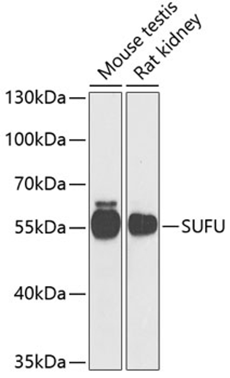 Western blot analysis of extracts of various cell lines, using SUFU antibody (22-465) at 1:1000 dilution.<br/>Secondary antibody: HRP Goat Anti-Rabbit IgG (H+L) at 1:10000 dilution.<br/>Lysates/proteins: 25ug per lane.<br/>Blocking buffer: 3% nonfat dry milk in TBST.<br/>Detection: ECL Basic Kit.<br/>Exposure time: 90s.