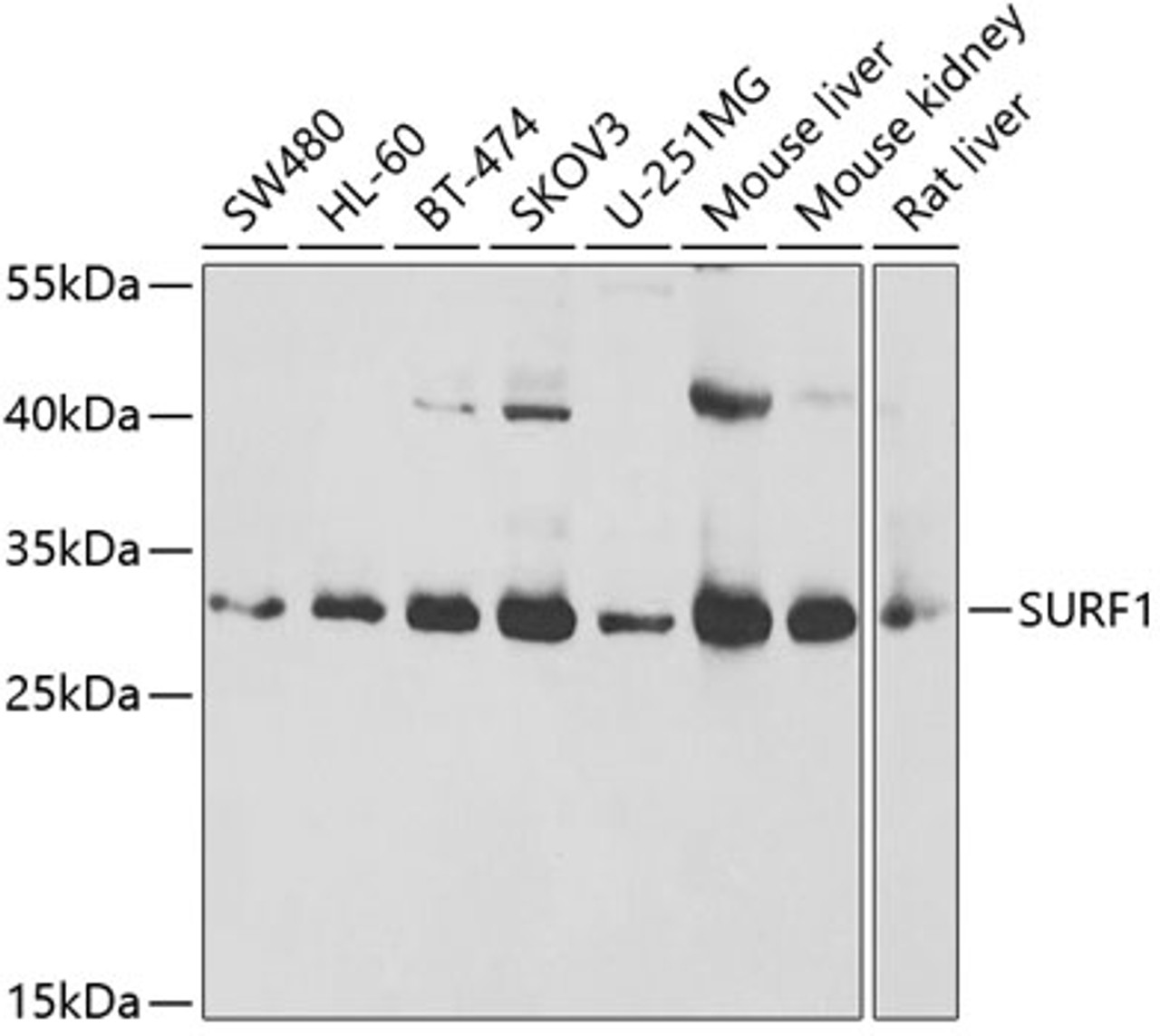 Western blot analysis of extracts of various cell lines, using SURF1 antibody (22-466) at 1:1000 dilution.<br/>Secondary antibody: HRP Goat Anti-Rabbit IgG (H+L) at 1:10000 dilution.<br/>Lysates/proteins: 25ug per lane.<br/>Blocking buffer: 3% nonfat dry milk in TBST.<br/>Detection: ECL Basic Kit.<br/>Exposure time: 3s.