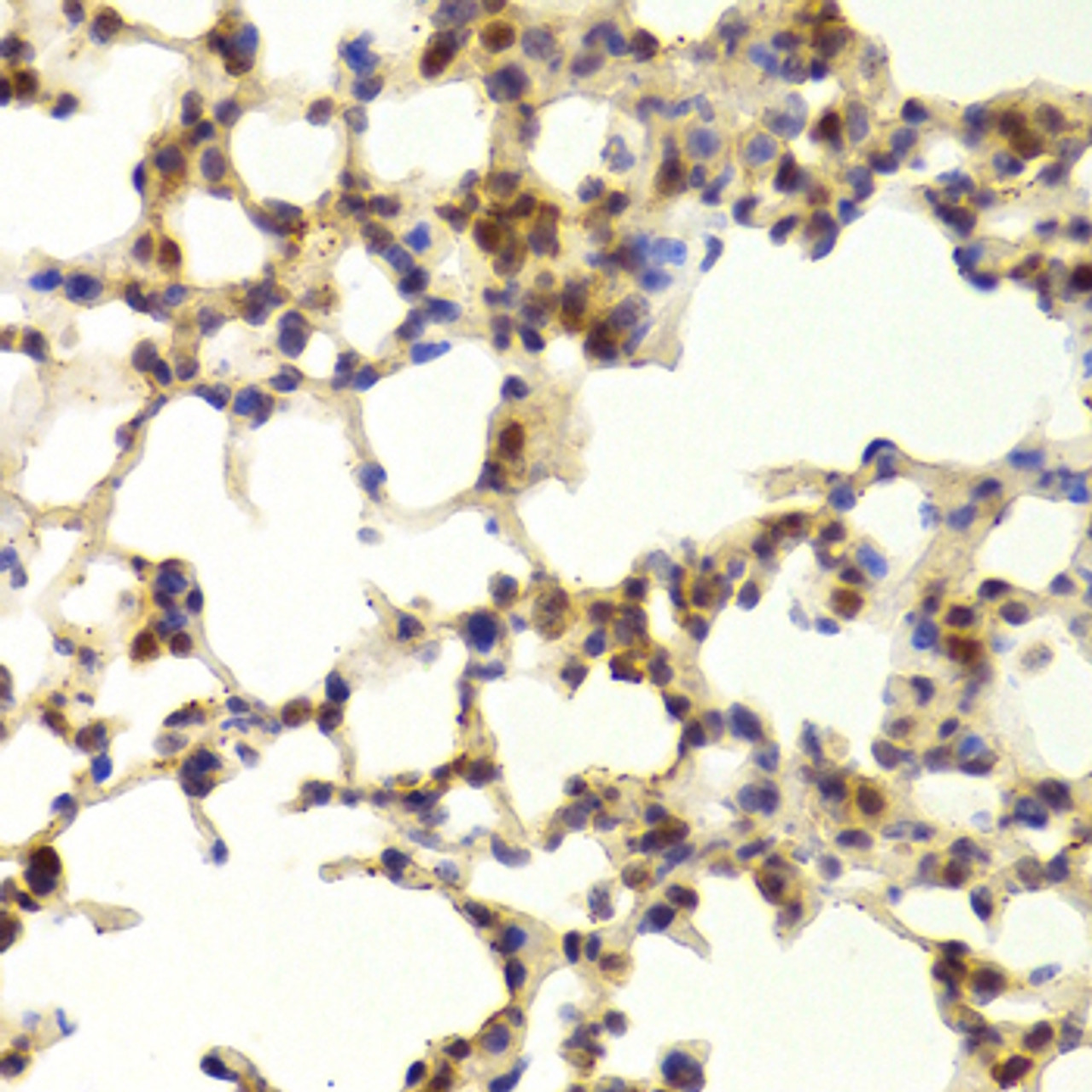 Immunohistochemistry of paraffin-embedded mouse lung using TAF1C Antibody (22-467) at dilution of 1:100 (40x lens) .