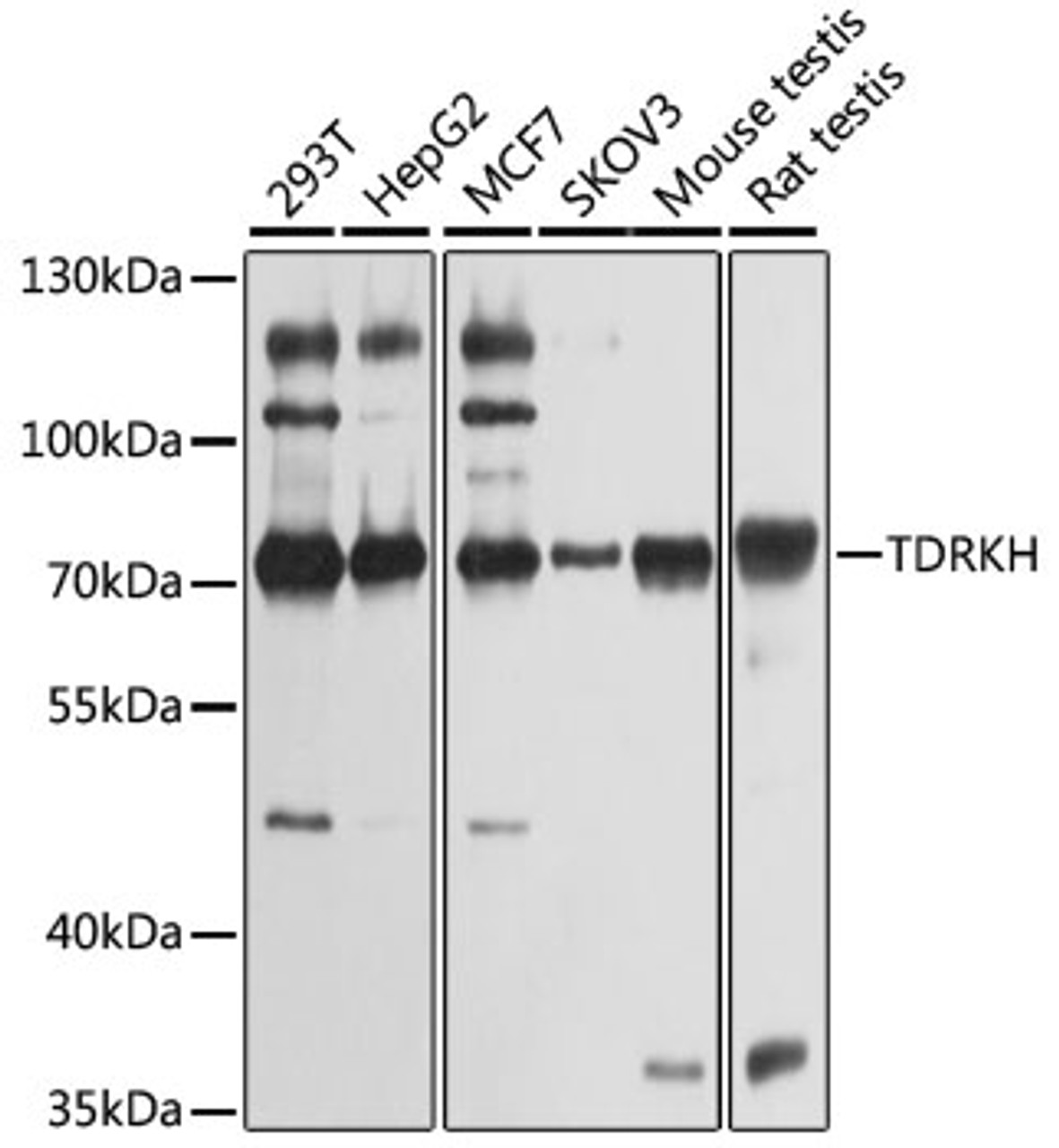 Western blot analysis of extracts of various cell lines, using TDRKH antibody (22-471) at 1:1000 dilution.<br/>Secondary antibody: HRP Goat Anti-Rabbit IgG (H+L) at 1:10000 dilution.<br/>Lysates/proteins: 25ug per lane.<br/>Blocking buffer: 3% nonfat dry milk in TBST.<br/>Detection: ECL Basic Kit.<br/>Exposure time: 1s.