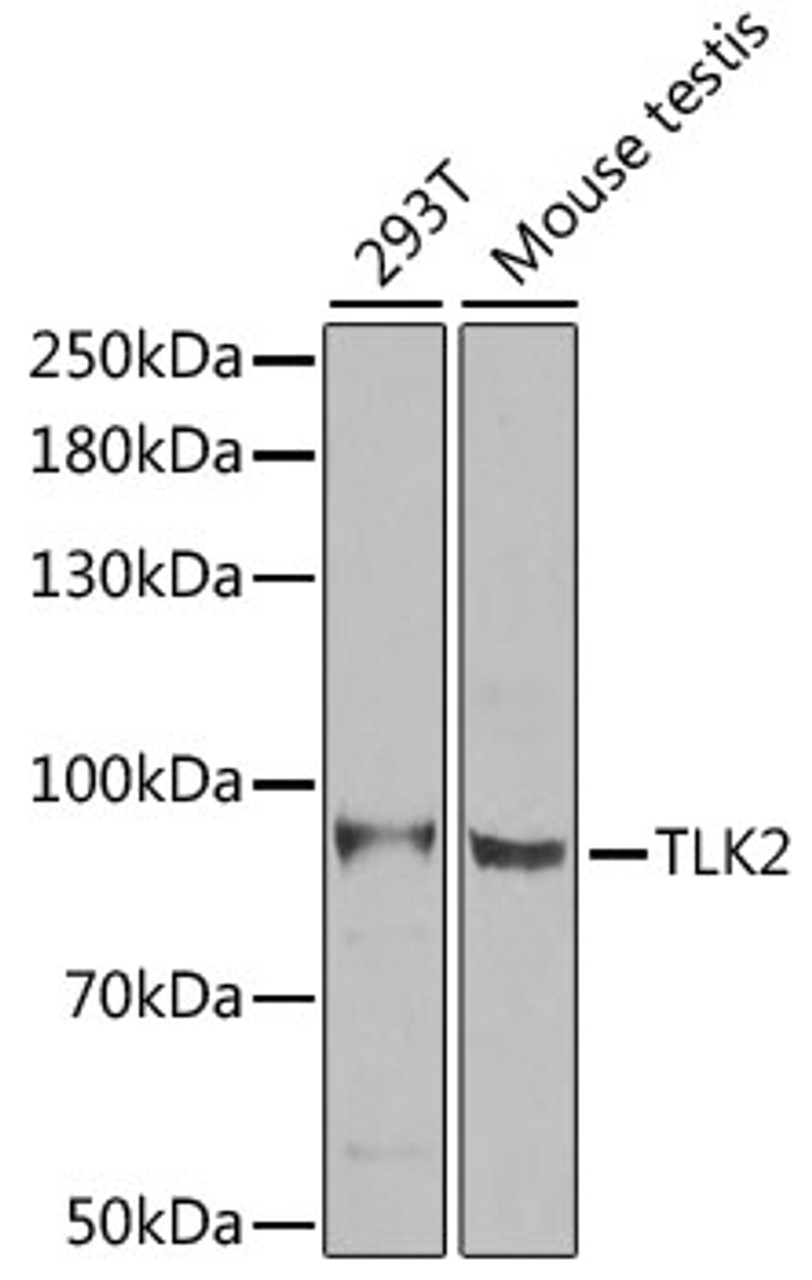 Western blot analysis of extracts of various cell lines, using TLK2 antibody (22-473) at 1:1000 dilution.<br/>Secondary antibody: HRP Goat Anti-Rabbit IgG (H+L) at 1:10000 dilution.<br/>Lysates/proteins: 25ug per lane.<br/>Blocking buffer: 3% nonfat dry milk in TBST.<br/>Detection: ECL Enhanced Kit.<br/>Exposure time: 90s.