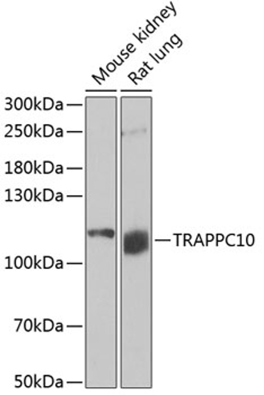 Western blot analysis of extracts of various cell lines, using TRAPPC10 antibody (22-478) at 1:1000 dilution.<br/>Secondary antibody: HRP Goat Anti-Rabbit IgG (H+L) at 1:10000 dilution.<br/>Lysates/proteins: 25ug per lane.<br/>Blocking buffer: 3% nonfat dry milk in TBST.<br/>Detection: ECL Basic Kit.<br/>Exposure time: 15min.