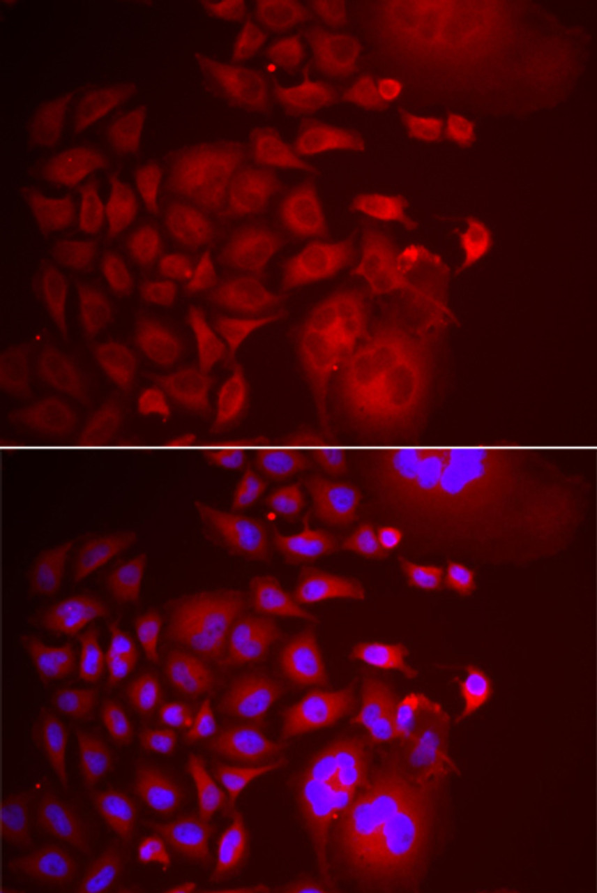 Immunofluorescence analysis of U2OS cells using TRAPPC10 antibody (22-478) . Blue: DAPI for nuclear staining.