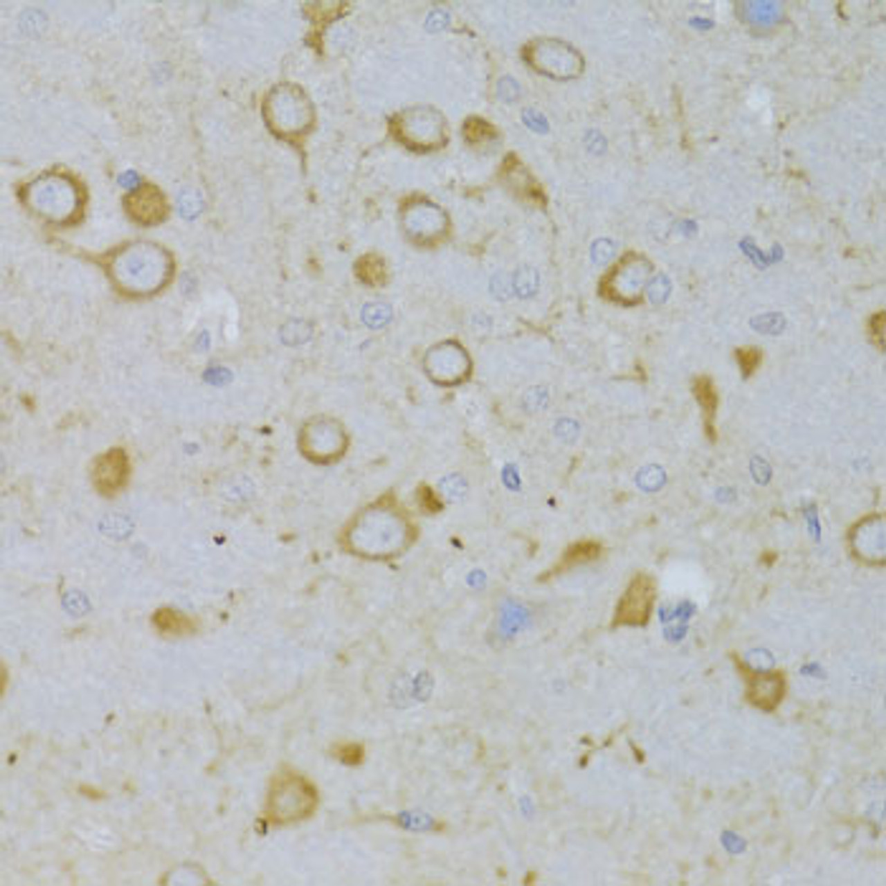 Immunohistochemistry of paraffin-embedded rat brain using TSHR Antibody (22-481) at dilution of 1:100 (40x lens) .