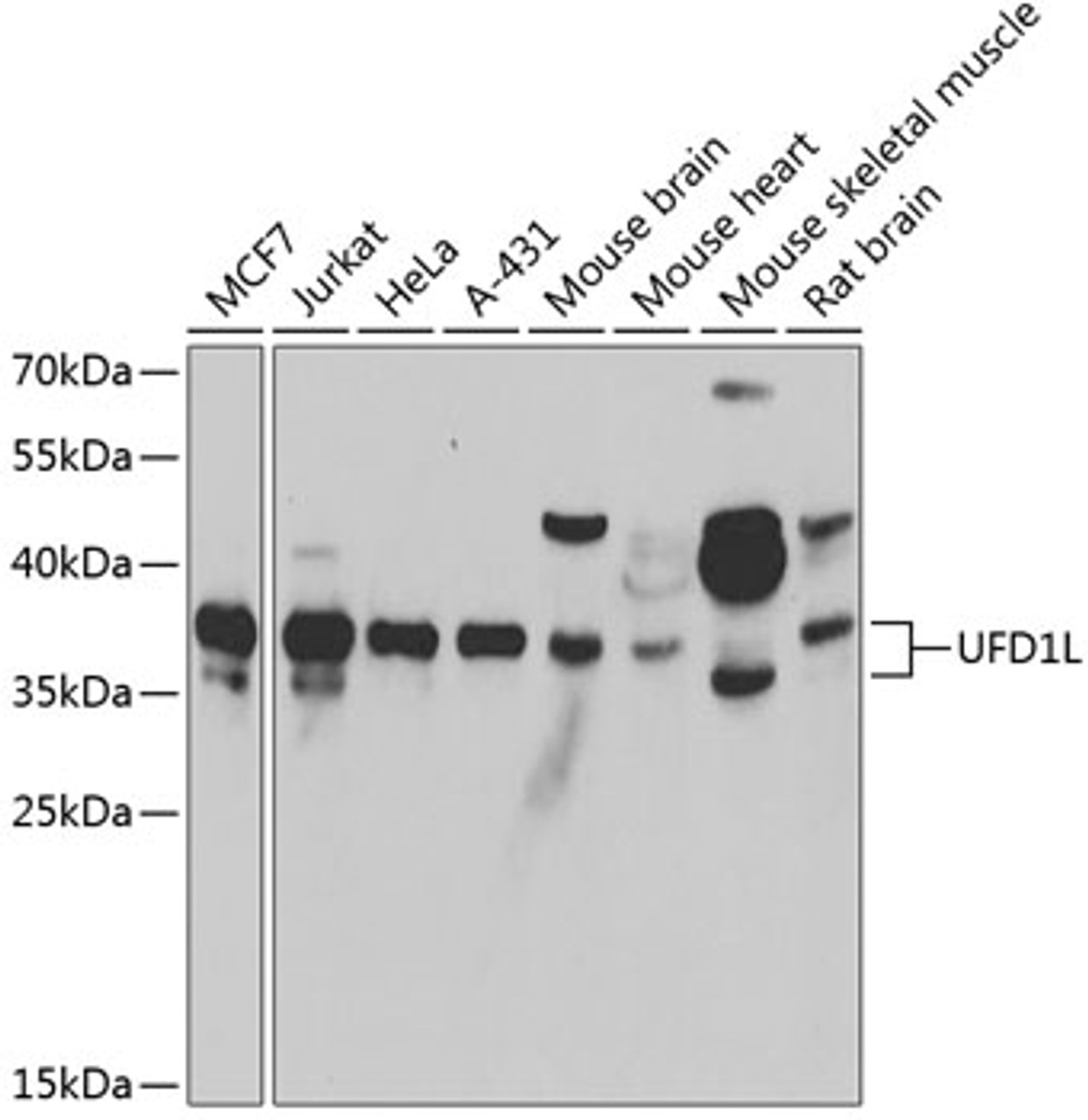 Western blot analysis of extracts of various cell lines, using UFD1L antibody (22-483) at 1:1000 dilution.<br/>Secondary antibody: HRP Goat Anti-Rabbit IgG (H+L) at 1:10000 dilution.<br/>Lysates/proteins: 25ug per lane.<br/>Blocking buffer: 3% nonfat dry milk in TBST.<br/>Detection: ECL Basic Kit.<br/>Exposure time: 10s.