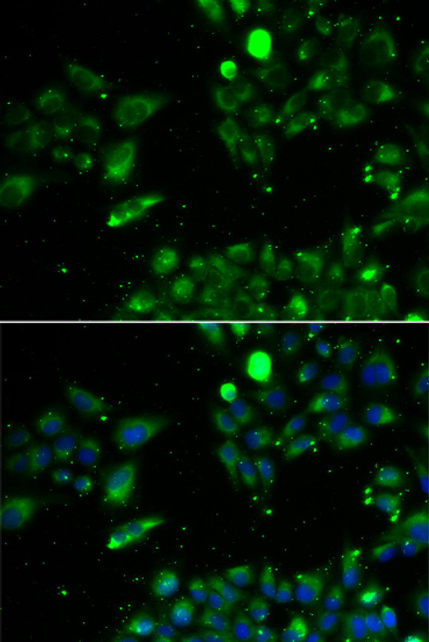 Immunofluorescence analysis of U2OS cells using UQCRFS1 antibody (22-484) . Blue: DAPI for nuclear staining.