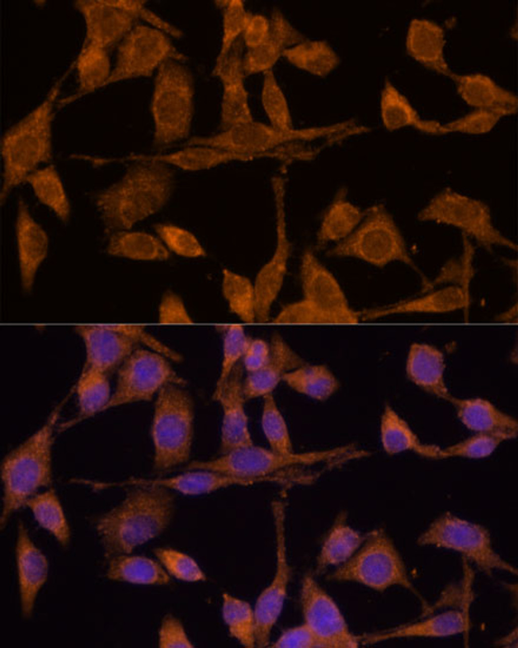 Immunofluorescence analysis of HeLa cells using USP15 Polyclonal Antibody (22-486) at dilution of 1:100 (40x lens) . Blue: DAPI for nuclear staining.