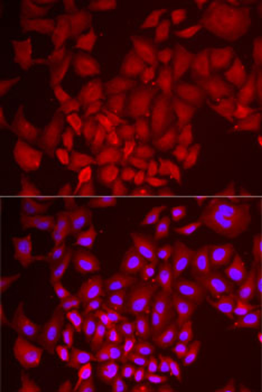Immunofluorescence analysis of MCF7 cells using DCAF7 antibody (22-487) . Blue: DAPI for nuclear staining.