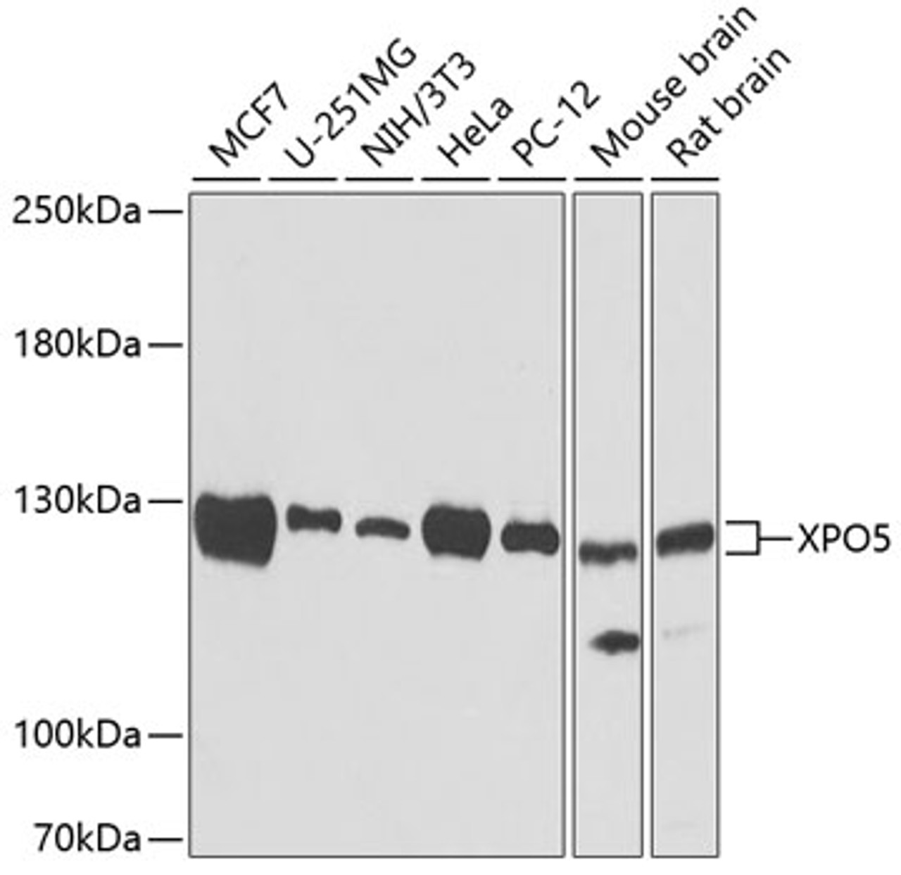 Western blot analysis of extracts of various cell lines, using XPO5 antibody (22-488) .<br/>Secondary antibody: HRP Goat Anti-Rabbit IgG (H+L) at 1:10000 dilution.<br/>Lysates/proteins: 25ug per lane.<br/>Blocking buffer: 3% nonfat dry milk in TBST.<br/>Detection: ECL Basic Kit.<br/>Exposure time: 90s.