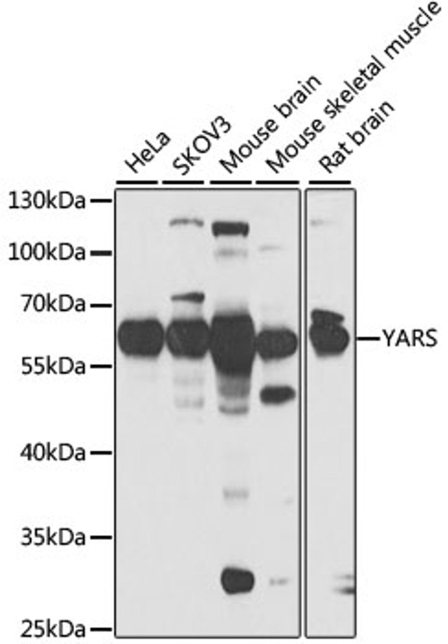 Western blot analysis of extracts of various cell lines, using YARS antibody (22-489) at 1:1000 dilution.<br/>Secondary antibody: HRP Goat Anti-Rabbit IgG (H+L) at 1:10000 dilution.<br/>Lysates/proteins: 25ug per lane.<br/>Blocking buffer: 3% nonfat dry milk in TBST.<br/>Detection: ECL Basic Kit.<br/>Exposure time: 30s.