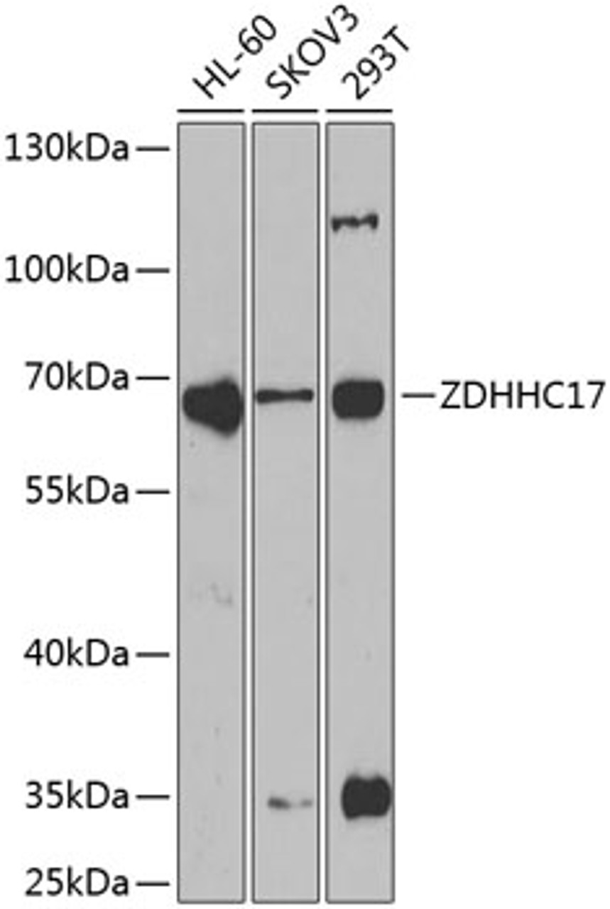 Western blot analysis of extracts of various cell lines, using ZDHHC17 antibody (22-490) at 1:1000 dilution.<br/>Secondary antibody: HRP Goat Anti-Rabbit IgG (H+L) at 1:10000 dilution.<br/>Lysates/proteins: 25ug per lane.<br/>Blocking buffer: 3% nonfat dry milk in TBST.<br/>Detection: ECL Basic Kit.<br/>Exposure time: 90s.