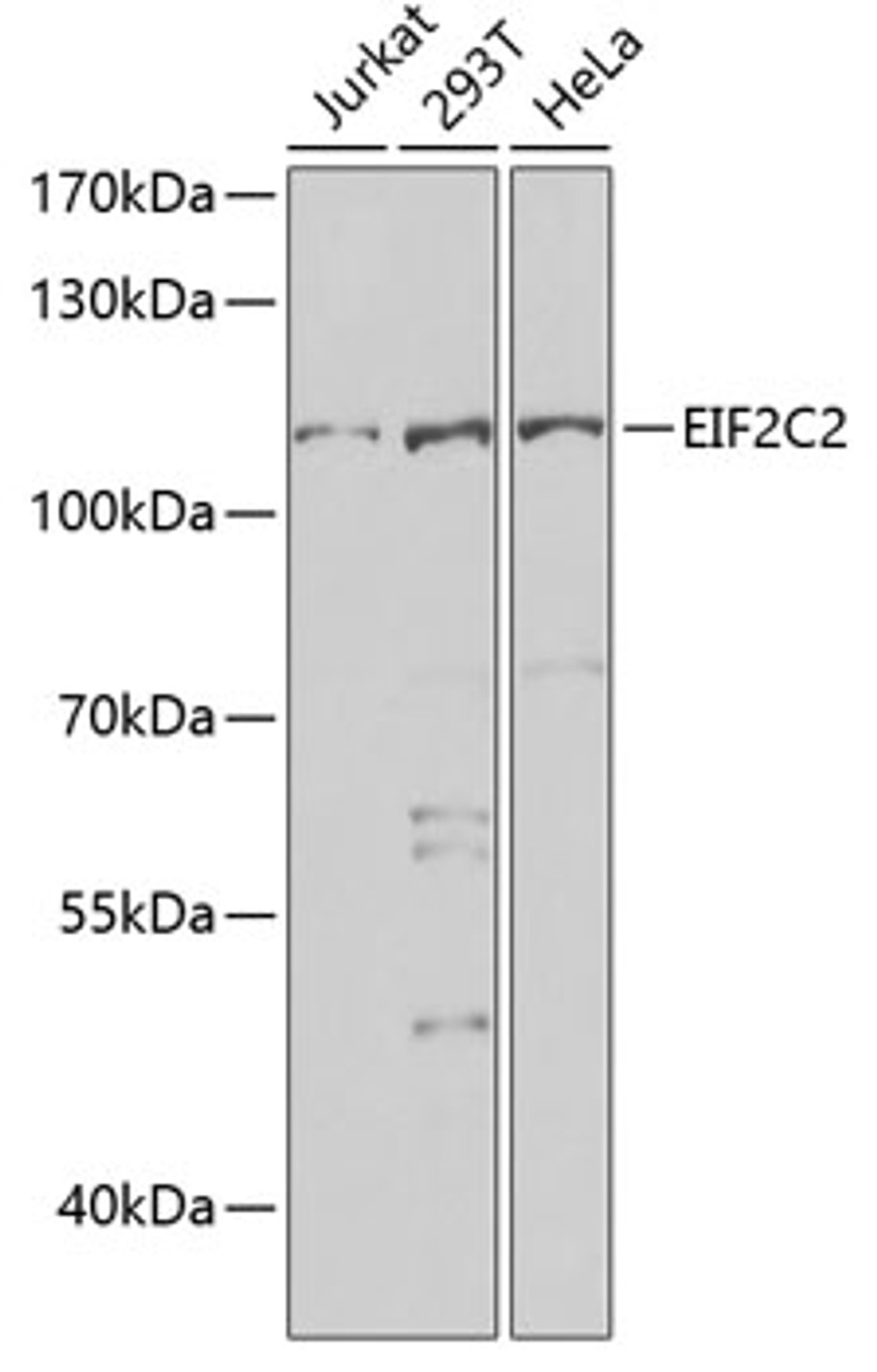 Western blot analysis of extracts of various cell lines, using AGO2 antibody (22-494) at 1:1000 dilution.<br/>Secondary antibody: HRP Goat Anti-Rabbit IgG (H+L) at 1:10000 dilution.<br/>Lysates/proteins: 25ug per lane.<br/>Blocking buffer: 3% nonfat dry milk in TBST.<br/>Detection: ECL Basic Kit.<br/>Exposure time: 20s.