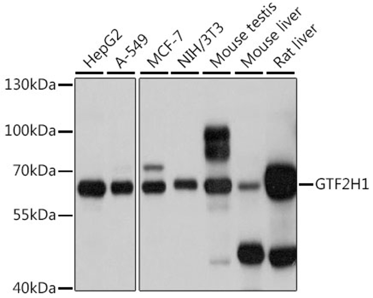 Western blot analysis of extracts of various cell lines, using GTF2H1 antibody (22-498) at 1:1000 dilution.<br/>Secondary antibody: HRP Goat Anti-Rabbit IgG (H+L) at 1:10000 dilution.<br/>Lysates/proteins: 25ug per lane.<br/>Blocking buffer: 3% nonfat dry milk in TBST.<br/>Detection: ECL Basic Kit.<br/>Exposure time: 1s.