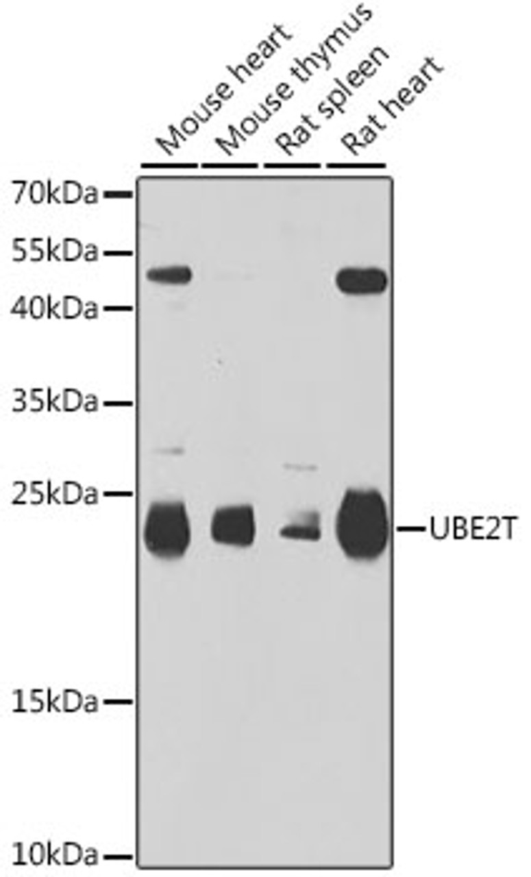 Western blot analysis of extracts of various cell lines, using UBE2T antibody (22-508) at 1:1000 dilution.<br/>Secondary antibody: HRP Goat Anti-Rabbit IgG (H+L) at 1:10000 dilution.<br/>Lysates/proteins: 25ug per lane.<br/>Blocking buffer: 3% nonfat dry milk in TBST.<br/>Detection: ECL Basic Kit.<br/>Exposure time: 90s.