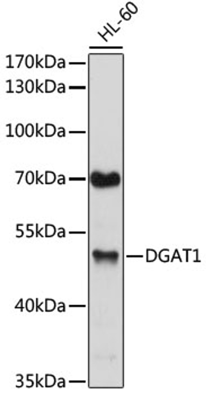 Western blot analysis of extracts of various cell lines, using DGAT1 antibody (22-510) at 1:1000 dilution.<br/>Secondary antibody: HRP Goat Anti-Rabbit IgG (H+L) at 1:10000 dilution.<br/>Lysates/proteins: 25ug per lane.<br/>Blocking buffer: 3% nonfat dry milk in TBST.<br/>Detection: ECL Enhanced Kit.<br/>Exposure time: 90s.