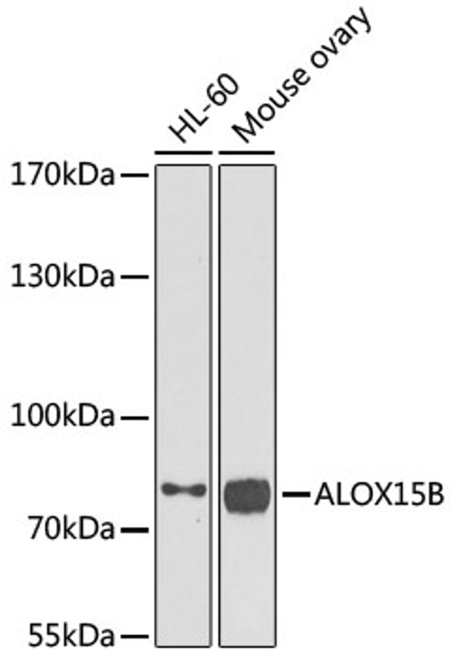 Western blot analysis of extracts of various cell lines, using ALOX15B antibody (22-514) at 1:1000 dilution.<br/>Secondary antibody: HRP Goat Anti-Rabbit IgG (H+L) at 1:10000 dilution.<br/>Lysates/proteins: 25ug per lane.<br/>Blocking buffer: 3% nonfat dry milk in TBST.<br/>Detection: ECL Basic Kit.<br/>Exposure time: 30s.