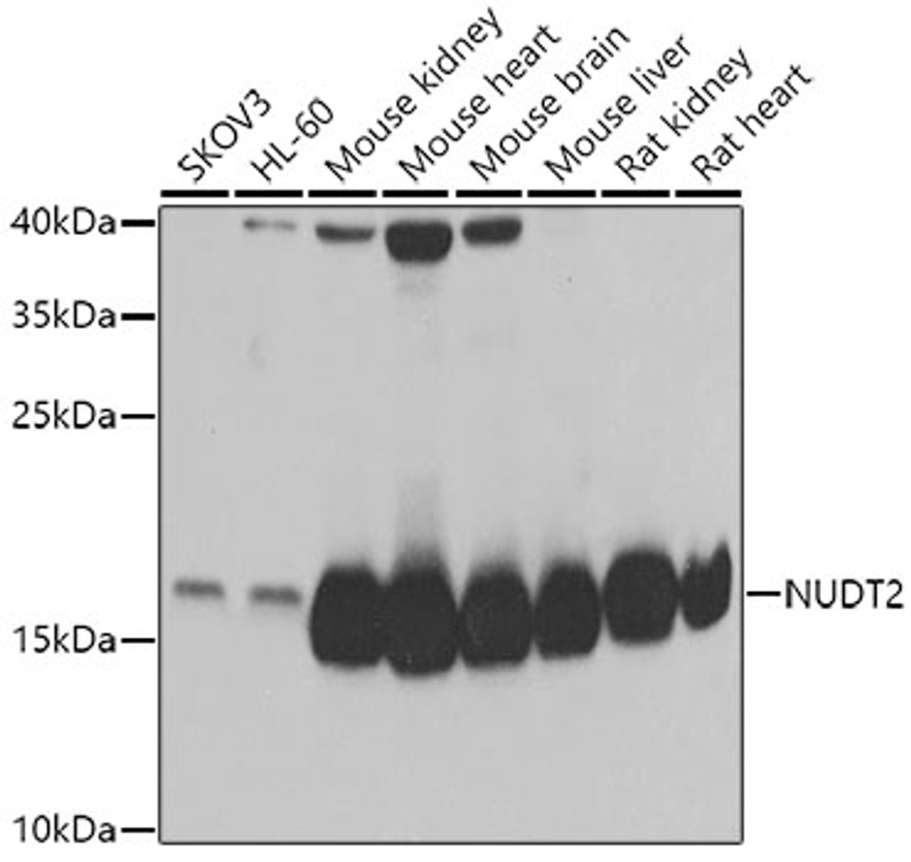 Western blot analysis of extracts of various cell lines, using NUDT2 antibody (22-516) at 1:1000 dilution.<br/>Secondary antibody: HRP Goat Anti-Rabbit IgG (H+L) at 1:10000 dilution.<br/>Lysates/proteins: 25ug per lane.<br/>Blocking buffer: 3% nonfat dry milk in TBST.<br/>Detection: ECL Basic Kit.<br/>Exposure time: 5s.