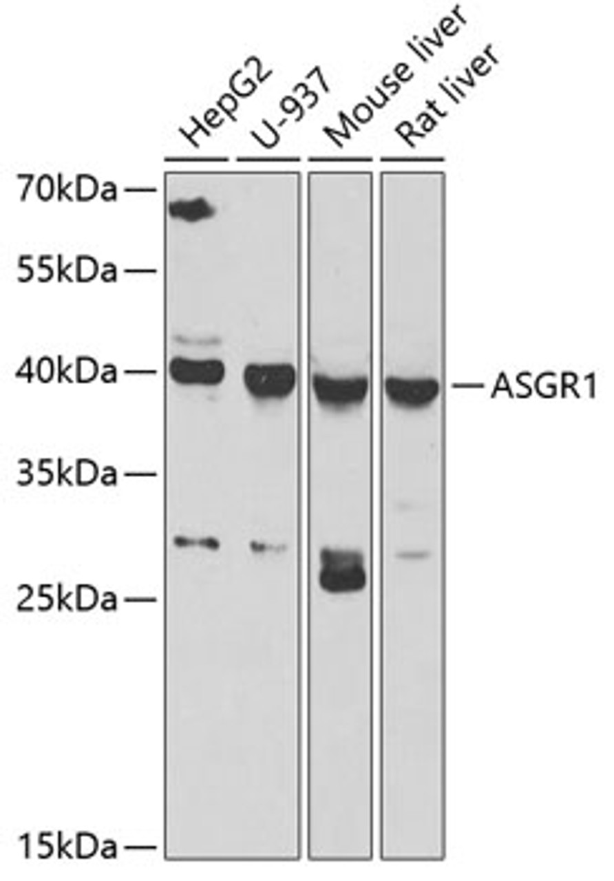 Western blot analysis of extracts of various cell lines, using ASGR1 antibody (22-519) at 1:1000 dilution.<br/>Secondary antibody: HRP Goat Anti-Rabbit IgG (H+L) at 1:10000 dilution.<br/>Lysates/proteins: 25ug per lane.<br/>Blocking buffer: 3% nonfat dry milk in TBST.<br/>Detection: ECL Basic Kit.<br/>Exposure time: 30s.
