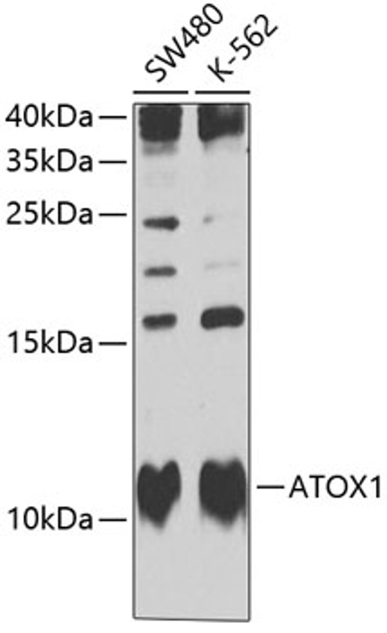Western blot analysis of extracts of various cell lines, using ATOX1 Antibody (22-522) at 1:1000 dilution.<br/>Secondary antibody: HRP Goat Anti-Rabbit IgG (H+L) at 1:10000 dilution.<br/>Lysates/proteins: 25ug per lane.<br/>Blocking buffer: 3% nonfat dry milk in TBST.<br/>Detection: ECL Basic Kit.<br/>Exposure time: 15s.