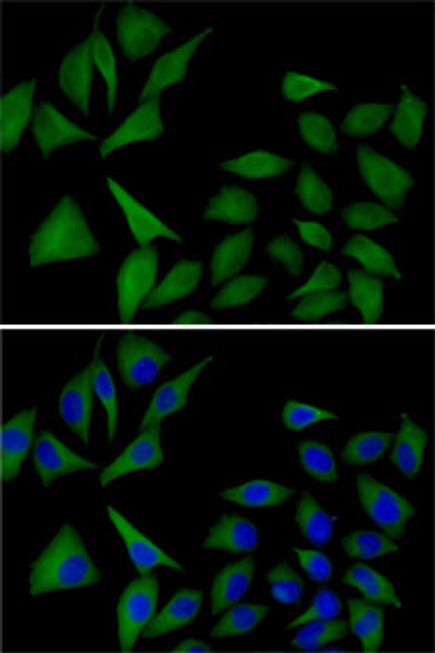 Immunofluorescence analysis of MCF7 cells using ATOX1 antibody (22-522) . Blue: DAPI for nuclear staining.