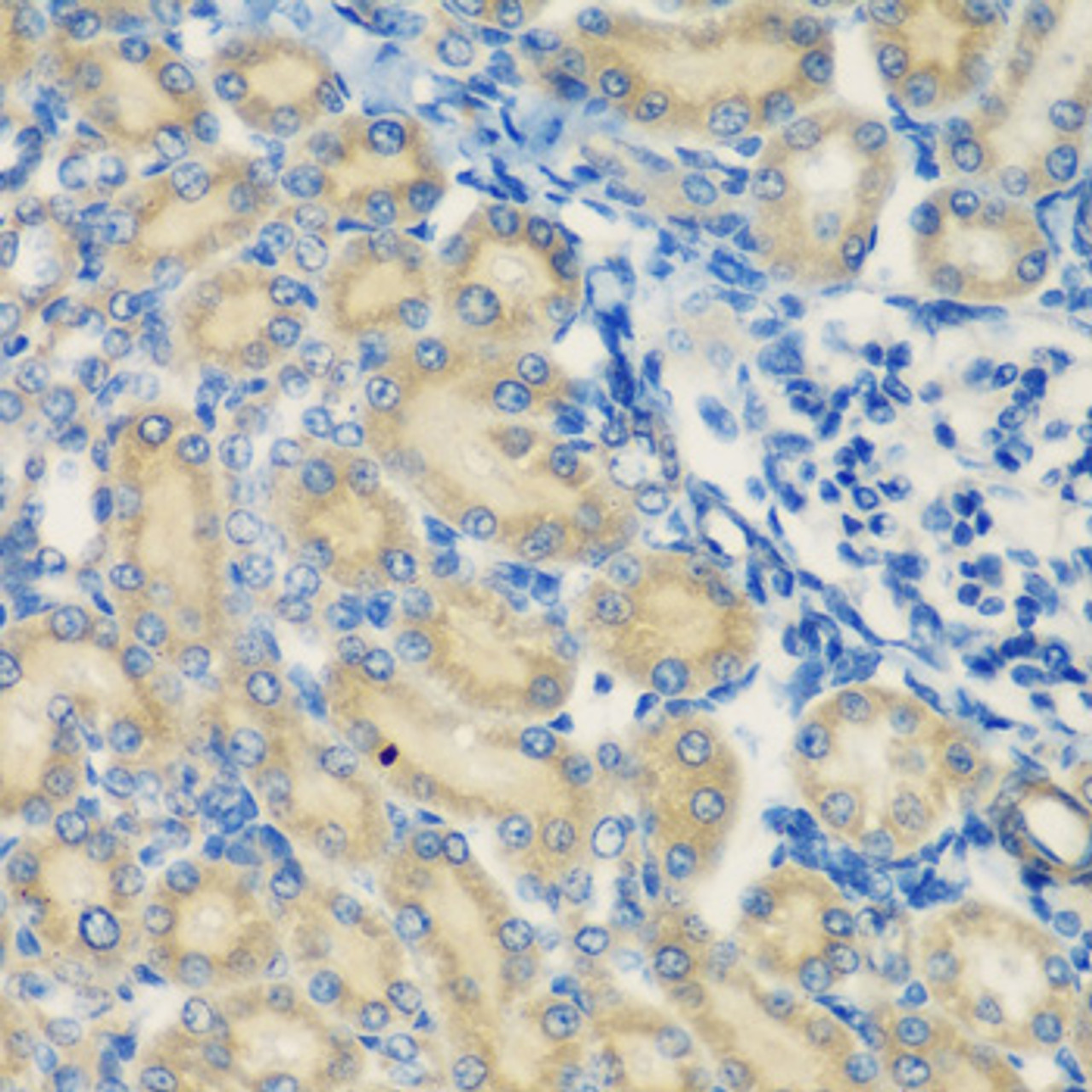 Immunohistochemistry of paraffin-embedded rat kidney using C1S antibody (22-525) at dilution of 1:200 (40x lens) .
