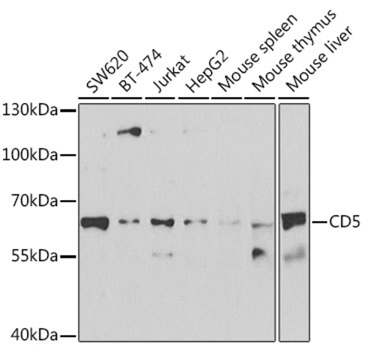 Western blot analysis of extracts of various cell lines, using CD5 antibody (22-528) at 1:1000 dilution.<br/>Secondary antibody: HRP Goat Anti-Rabbit IgG (H+L) at 1:10000 dilution.<br/>Lysates/proteins: 25ug per lane.<br/>Blocking buffer: 3% nonfat dry milk in TBST.<br/>Detection: ECL Basic Kit.<br/>Exposure time: 90s.