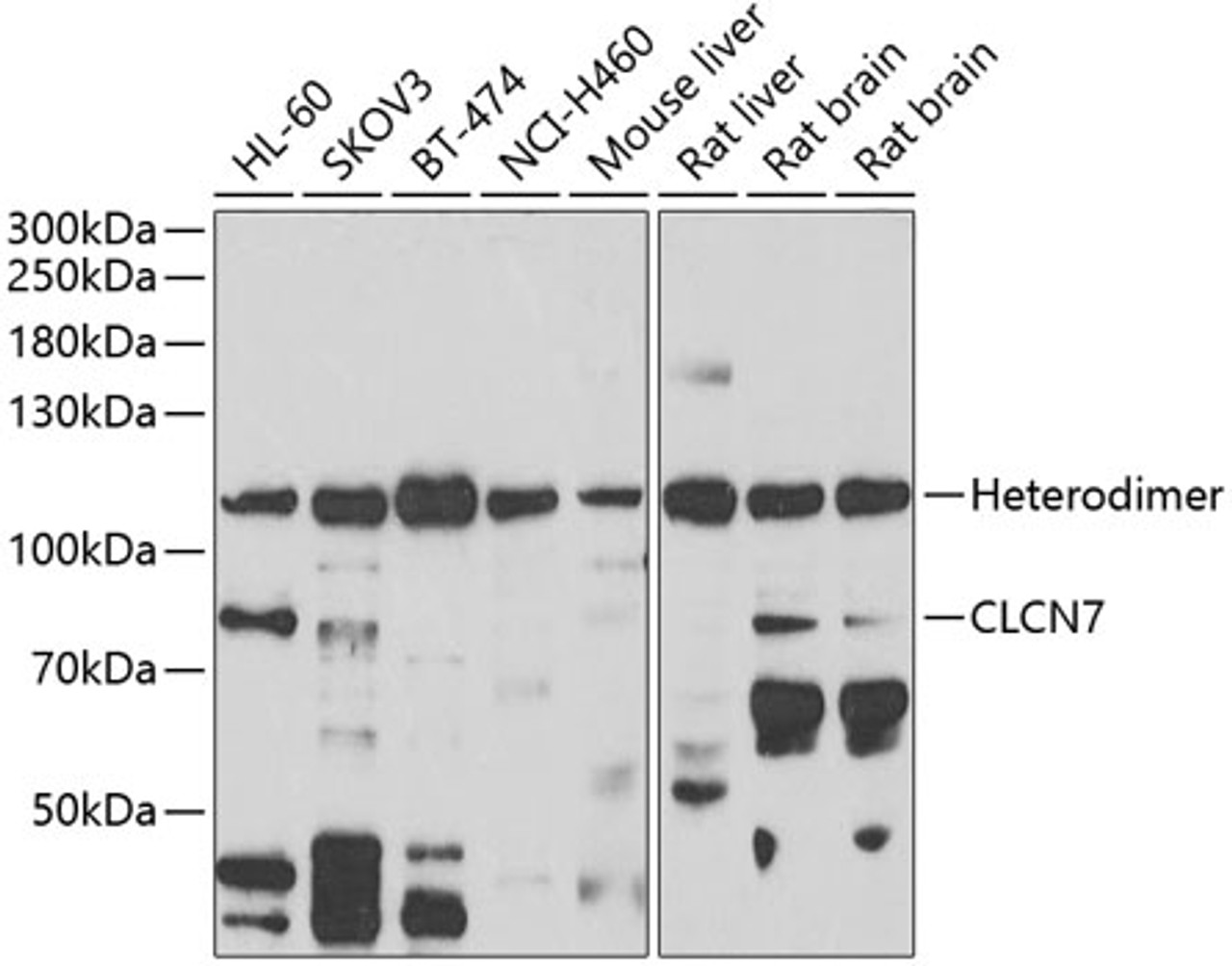 Western blot analysis of extracts of various cell lines, using CLCN7 antibody (22-531) at 1:1000 dilution._Secondary antibody: HRP Goat Anti-Rabbit IgG (H+L) at 1:10000 dilution._Lysates/proteins: 25ug per lane._Blocking buffer: 3% nonfat dry milk in TBST._Detection: ECL Enhanced Kit._Exposure time: 90s.