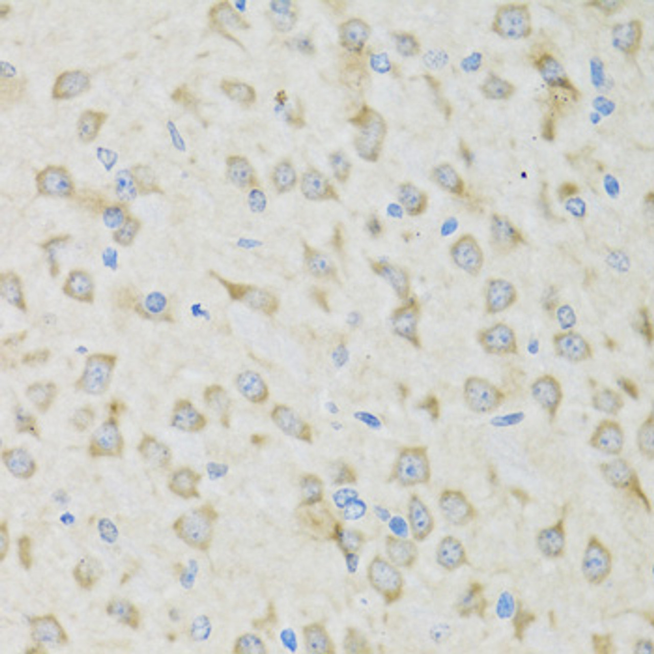 Immunohistochemistry of paraffin-embedded mouse brain using CLCN7 antibody (22-531) at dilution of 1:100 (40x lens) .