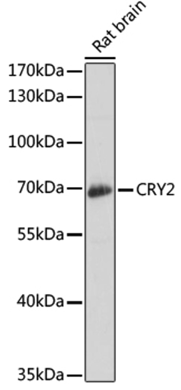 Western blot analysis of extracts of rat brain, using CRY2 antibody (22-533) at 1:1000 dilution.<br/>Secondary antibody: HRP Goat Anti-Rabbit IgG (H+L) at 1:10000 dilution.<br/>Lysates/proteins: 25ug per lane.<br/>Blocking buffer: 3% nonfat dry milk in TBST.<br/>Detection: ECL Basic Kit.<br/>Exposure time: 3s.